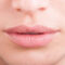 Alles, was Sie zur Lippenvergrößerung mit Hyaluronsäure wissen müssen